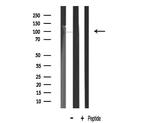 LTK Antibody in Western Blot (WB)