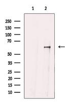 GRK4 Polyclonal Antibody
