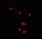 GTF2H1 Polyclonal Antibody