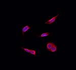 Recoverin Polyclonal Antibody