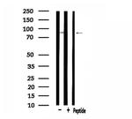 SOX6 Polyclonal Antibody