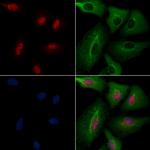 CLK2 Polyclonal Antibody