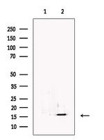 RBP5 Polyclonal Antibody