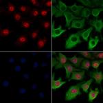 AKAP17A Polyclonal Antibody