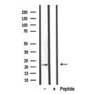 LTB Polyclonal Antibody