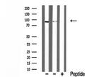 DYRK1A Antibody in Western Blot (WB)