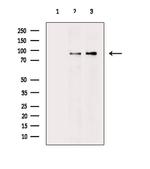 DYRK1A Polyclonal Antibody