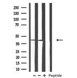 PDGFRL Polyclonal Antibody