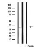 SURF1 Polyclonal Antibody