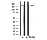 TRAP220 Polyclonal Antibody
