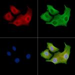 ADCK5 Polyclonal Antibody