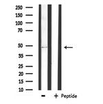 AGPAT9 Antibody in Western Blot (WB)