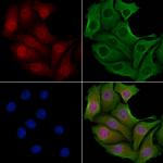 TSSC1 Antibody in Immunocytochemistry (ICC/IF)
