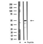 TSSC1 Antibody in Western Blot (WB)
