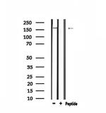 LMTK2 Polyclonal Antibody
