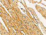 TUSC5 Polyclonal Antibody