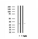 SPIC Antibody in Western Blot (WB)