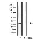 SPIC Antibody in Western Blot (WB)