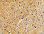 PARD3 Polyclonal Antibody