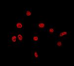 TAF15 Polyclonal Antibody