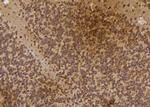IP6K3 Polyclonal Antibody