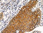 ATF6-beta Polyclonal Antibody