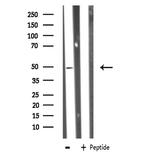 ZNF436 Antibody in Western Blot (WB)