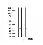 AKIP1 Antibody in Western Blot (WB)