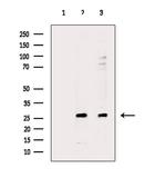 AKIP1 Polyclonal Antibody