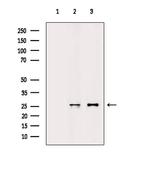 AKIP1 Antibody in Western Blot (WB)