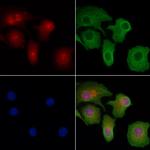 AATF Polyclonal Antibody