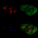 ZC3H7B Polyclonal Antibody