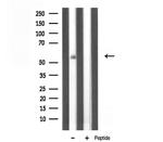 TBX22 Antibody in Western Blot (WB)