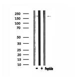 BCOR Polyclonal Antibody