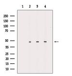 CADM2 Polyclonal Antibody