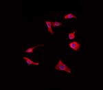 CCR11 Polyclonal Antibody