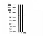 CDKAL1 Antibody in Western Blot (WB)