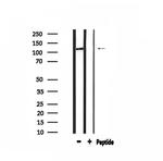 COL1A2 Antibody in Western Blot (WB)