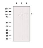 COL6A2 Polyclonal Antibody