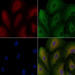 DNAJB4 Polyclonal Antibody