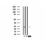 HSPB2 Antibody in Western Blot (WB)