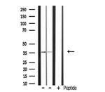 POU4F3 Polyclonal Antibody