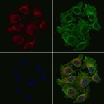 MRPL10 Polyclonal Antibody