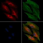 MRPL11 Polyclonal Antibody