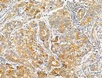 MRPL13 Antibody in Immunohistochemistry (Paraffin) (IHC (P))