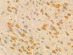 MRPL13 Antibody in Immunohistochemistry (Paraffin) (IHC (P))