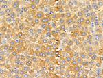 MRPL13 Antibody in Immunohistochemistry (Paraffin) (IHC (P))