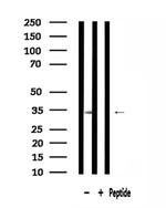 MRPL15 Antibody in Western Blot (WB)