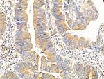 RPS18 Antibody in Immunohistochemistry (Paraffin) (IHC (P))