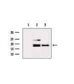 RPS19 Polyclonal Antibody